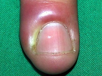 Nails Doctor V Nails Doctor V